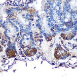 Immunohistochemistry - Anti-ITLN1 Antibody (A10089) - Antibodies.com