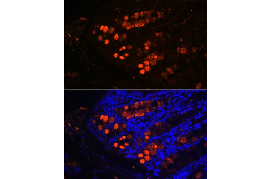 Immunofluorescence - Anti-ITLN1 Antibody (A10089) - Antibodies.com