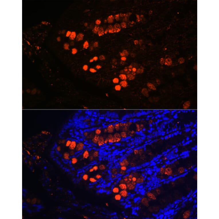 Immunofluorescence - Anti-ITLN1 Antibody (A10089) - Antibodies.com