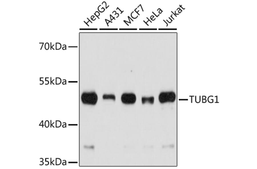 Western Blot - Anti-TUBG1 Antibody (A7246) - Antibodies.com