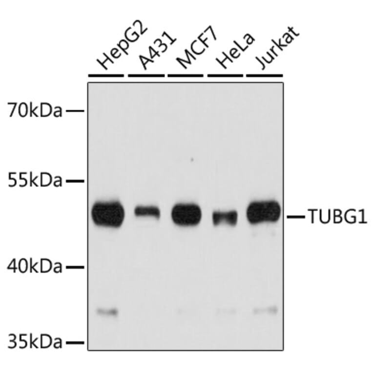 Western Blot - Anti-TUBG1 Antibody (A7246) - Antibodies.com