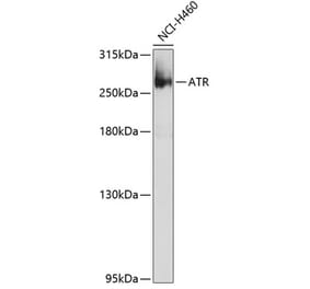 Western Blot - Anti-ATR Antibody (A10092) - Antibodies.com