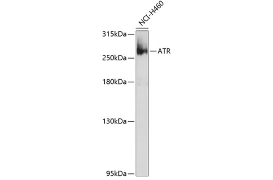 Western Blot - Anti-ATR Antibody (A10092) - Antibodies.com