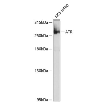 Western Blot - Anti-ATR Antibody (A10092) - Antibodies.com