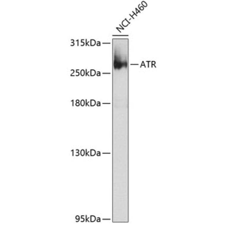 Western Blot - Anti-ATR Antibody (A10092) - Antibodies.com