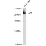 Western Blot - Anti-ATR Antibody (A10092) - Antibodies.com