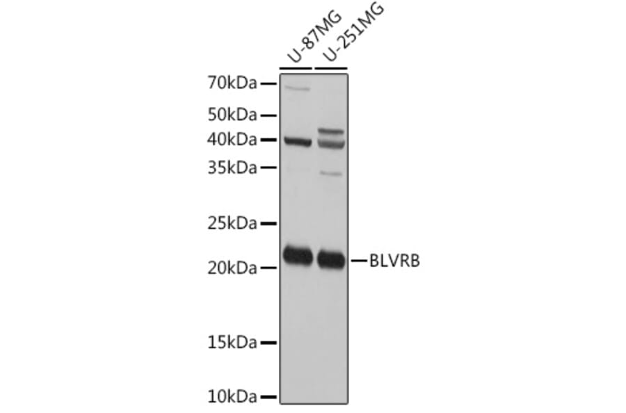 Western Blot - Anti-FLR Antibody (A10093) - Antibodies.com