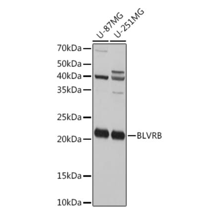 Western Blot - Anti-FLR Antibody (A10093) - Antibodies.com