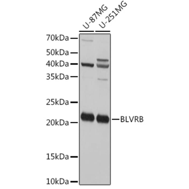 Western Blot - Anti-FLR Antibody (A10093) - Antibodies.com