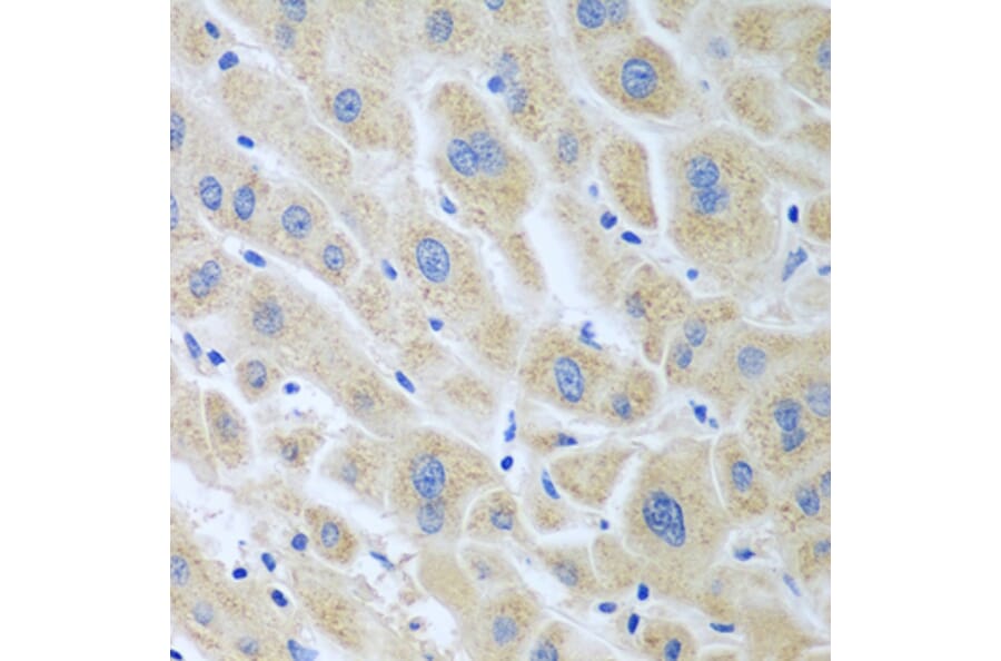 Immunohistochemistry - Anti-FLR Antibody (A10093) - Antibodies.com