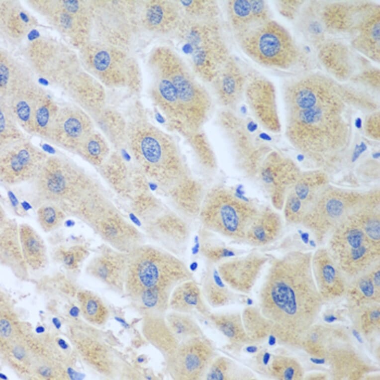 Immunohistochemistry - Anti-FLR Antibody (A10093) - Antibodies.com