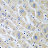 Immunohistochemistry - Anti-FLR Antibody (A10093) - Antibodies.com