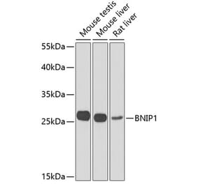 Western Blot - Anti-BNIP1 Antibody (A10094) - Antibodies.com