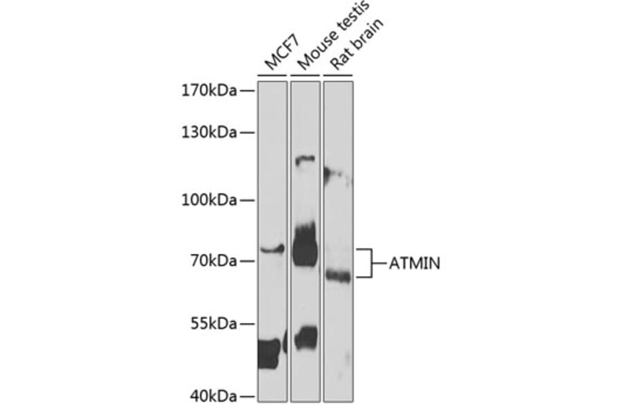 Western Blot - Anti-ATMIN Antibody (A10095) - Antibodies.com
