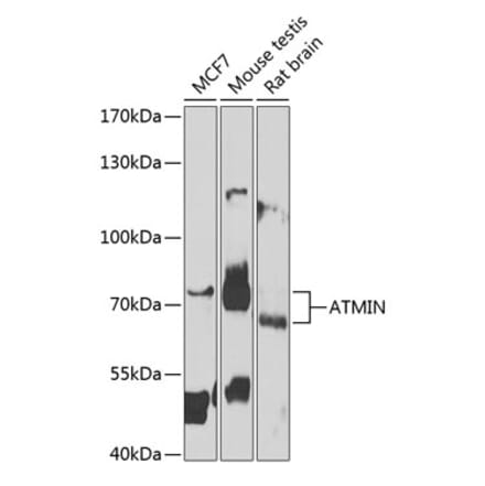 Western Blot - Anti-ATMIN Antibody (A10095) - Antibodies.com