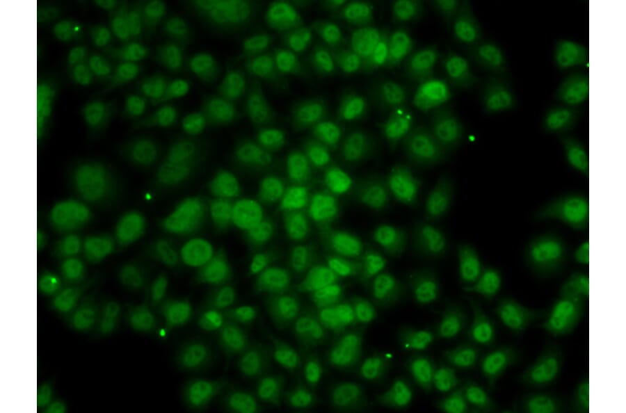 Immunofluorescence - Anti-ATMIN Antibody (A10095) - Antibodies.com