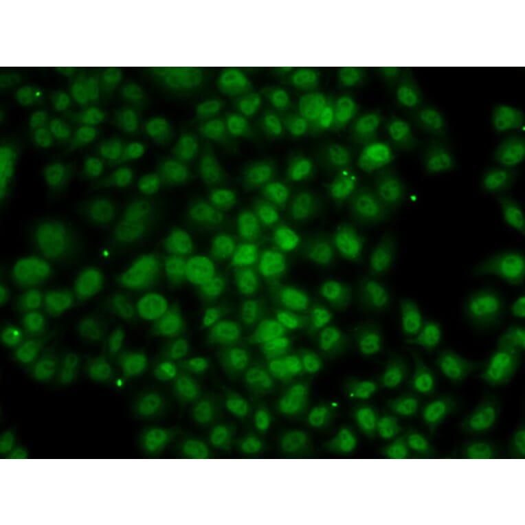 Immunofluorescence - Anti-ATMIN Antibody (A10095) - Antibodies.com