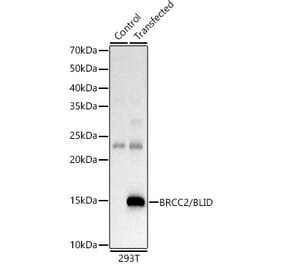Western Blot - Anti-BLID Antibody (A10097) - Antibodies.com