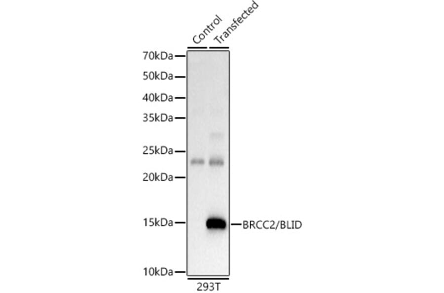 Western Blot - Anti-BLID Antibody (A10097) - Antibodies.com