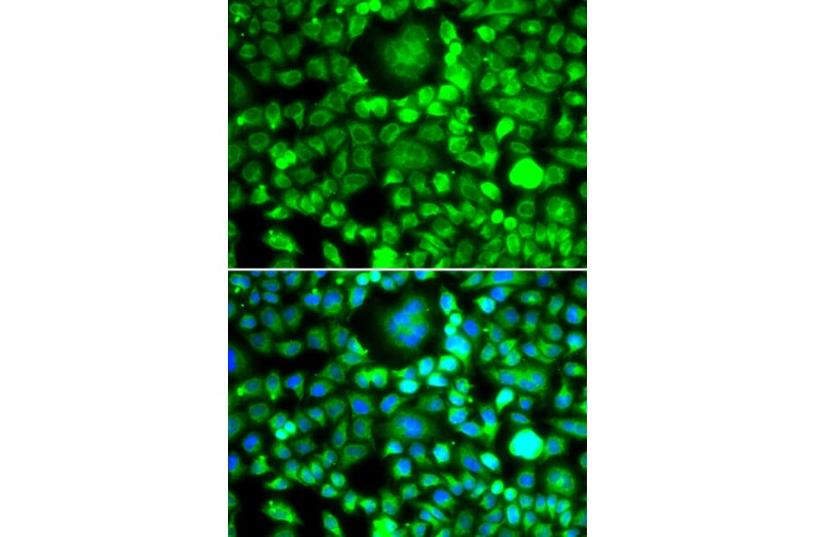 Immunofluorescence - Anti-BLID Antibody (A10097) - Antibodies.com