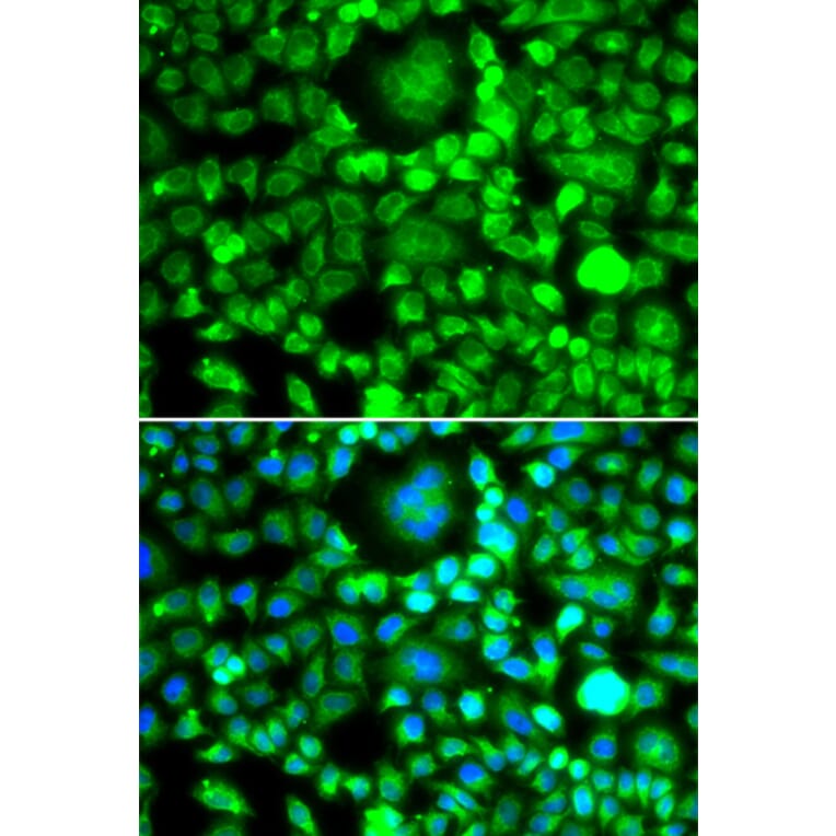 Immunofluorescence - Anti-BLID Antibody (A10097) - Antibodies.com