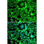 Immunofluorescence - Anti-BLID Antibody (A10097) - Antibodies.com