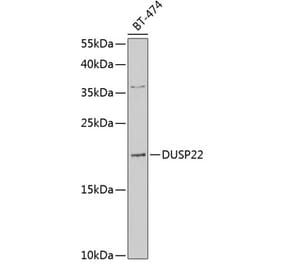 Western Blot - Anti-DUSP22 Antibody (A10098) - Antibodies.com