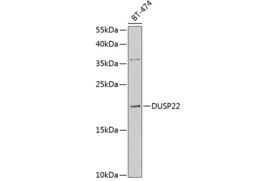 Western Blot - Anti-DUSP22 Antibody (A10098) - Antibodies.com