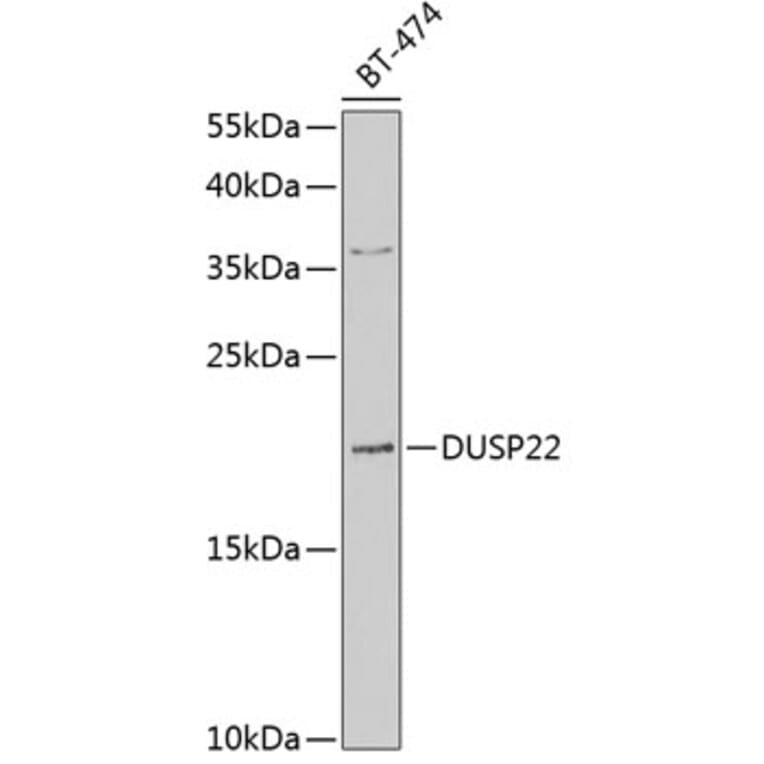Western Blot - Anti-DUSP22 Antibody (A10098) - Antibodies.com