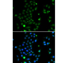 Immunofluorescence - Anti-GCM1 Antibody (A10099) - Antibodies.com