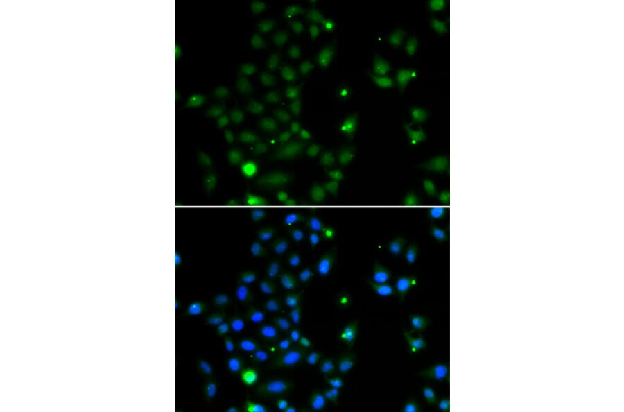 Immunofluorescence - Anti-GCM1 Antibody (A10099) - Antibodies.com