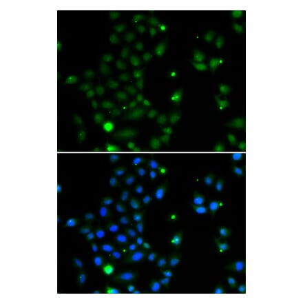 Immunofluorescence - Anti-GCM1 Antibody (A10099) - Antibodies.com