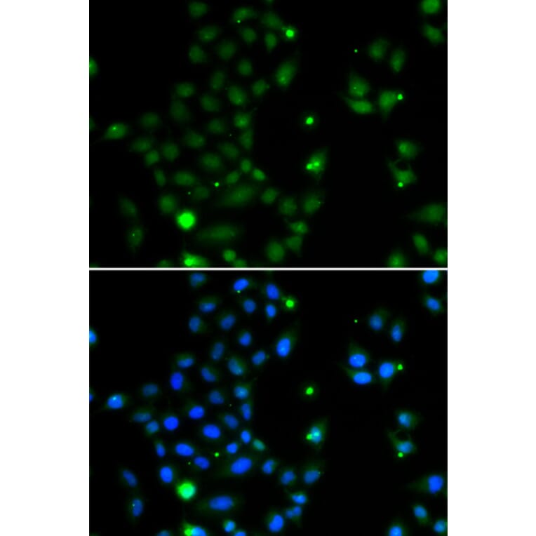 Immunofluorescence - Anti-GCM1 Antibody (A10099) - Antibodies.com