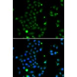 Immunofluorescence - Anti-GCM1 Antibody (A10099) - Antibodies.com