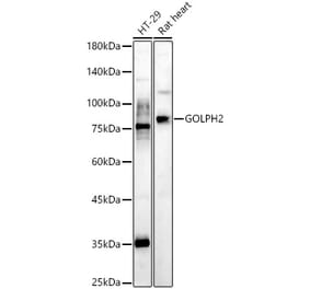 Western Blot - Anti-GOLPH2 Antibody (A10100) - Antibodies.com