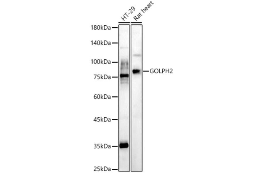 Western Blot - Anti-GOLPH2 Antibody (A10100) - Antibodies.com