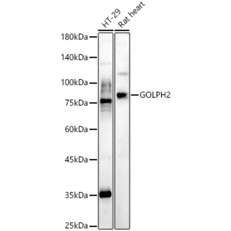 Western Blot - Anti-GOLPH2 Antibody (A10100) - Antibodies.com