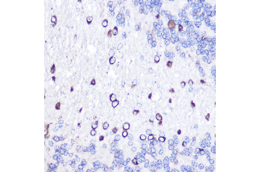 Immunohistochemistry - Anti-GOLPH2 Antibody (A10100) - Antibodies.com