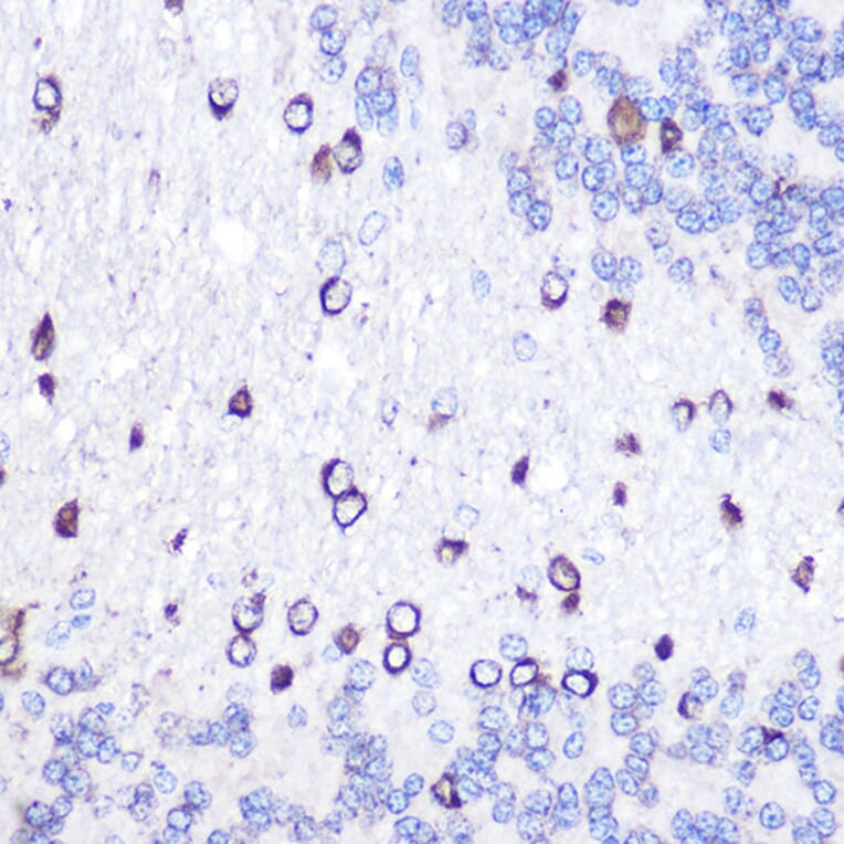 Immunohistochemistry - Anti-GOLPH2 Antibody (A10100) - Antibodies.com
