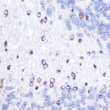 Immunohistochemistry - Anti-GOLPH2 Antibody (A10100) - Antibodies.com