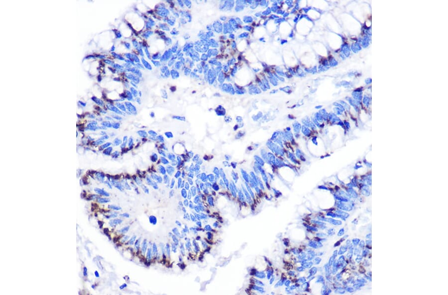 Immunohistochemistry - Anti-GOLPH2 Antibody (A10100) - Antibodies.com