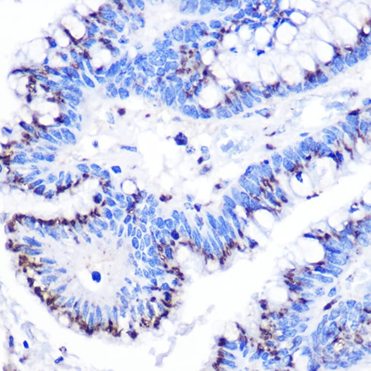 Immunohistochemistry - Anti-GOLPH2 Antibody (A10100) - Antibodies.com
