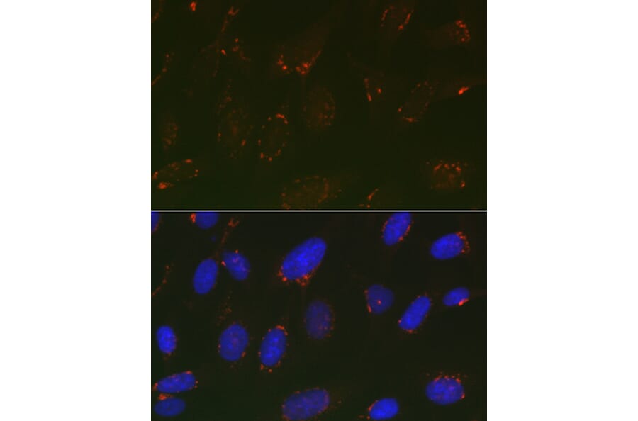 Immunofluorescence - Anti-GOLPH2 Antibody (A10100) - Antibodies.com