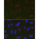Immunofluorescence - Anti-GOLPH2 Antibody (A10100) - Antibodies.com
