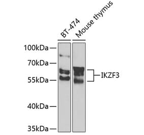 Western Blot - Anti-IKZF3 Antibody (A10101) - Antibodies.com