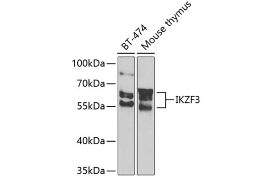 Western Blot - Anti-IKZF3 Antibody (A10101) - Antibodies.com