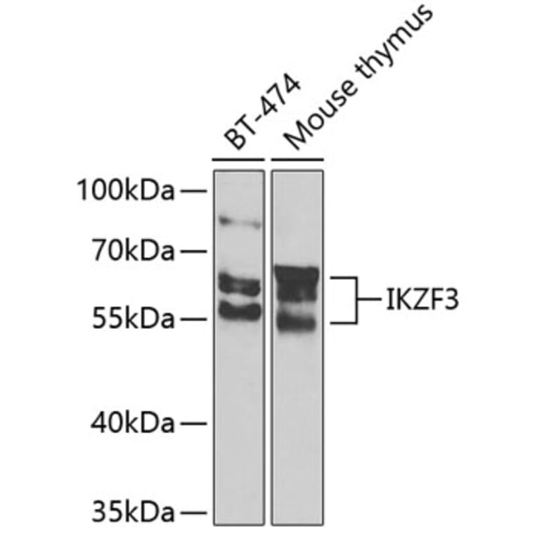 Western Blot - Anti-IKZF3 Antibody (A10101) - Antibodies.com
