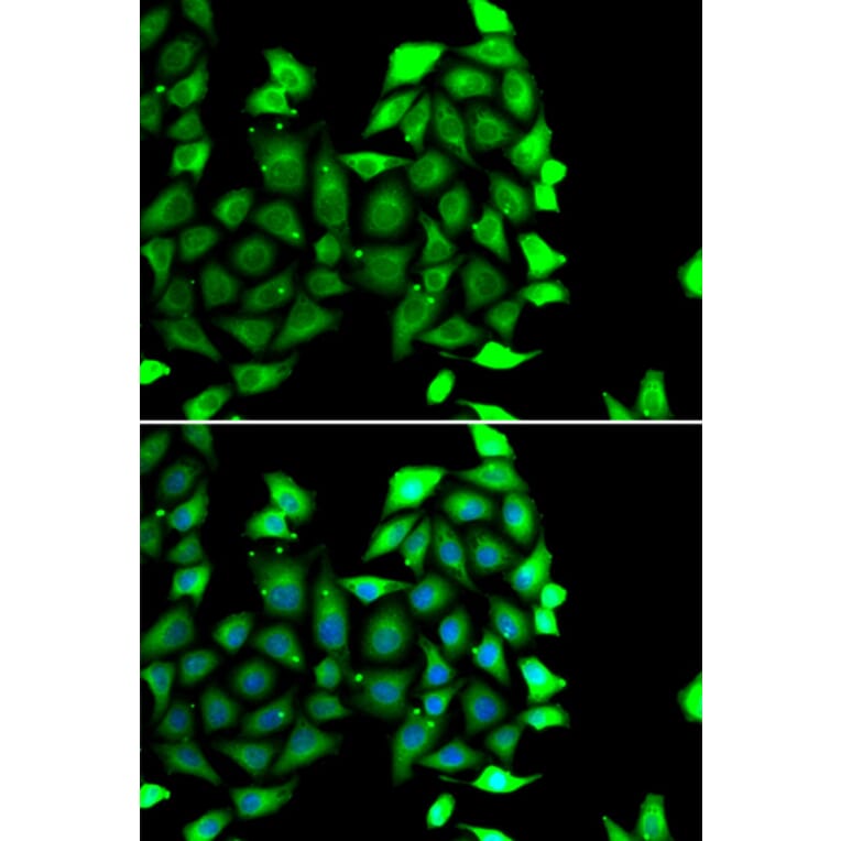 Immunofluorescence - Anti-IKZF3 Antibody (A10101) - Antibodies.com