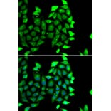 Immunofluorescence - Anti-IKZF3 Antibody (A10101) - Antibodies.com
