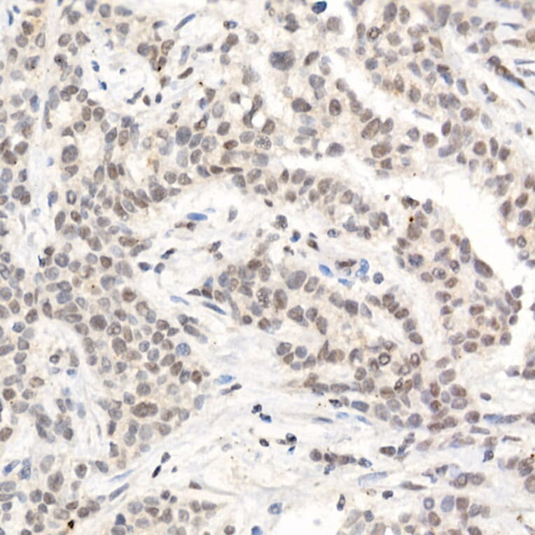 Immunohistochemistry - Anti-L3MBTL3 Antibody (A10103) - Antibodies.com